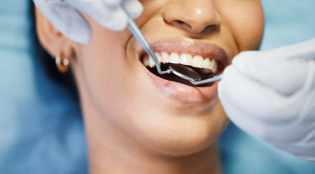 Best Emergency Dentist for Knocked-Out Tooth in Canfield, OH