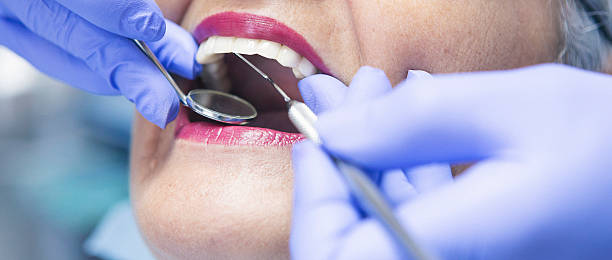 Best Weekend Emergency Dentist in Canfield, OH